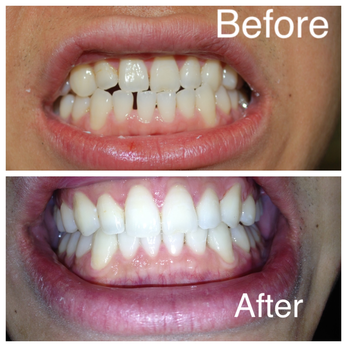 Smile Gallery West Hempstead, NY Ashu Sachdev, DDS